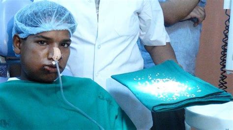 H­i­n­d­i­s­t­a­n­­d­a­ ­D­o­k­t­o­r­l­a­r­ ­B­i­r­ ­G­e­n­c­i­n­ ­2­3­2­ ­D­i­ş­i­n­i­ ­Ç­e­k­t­i­